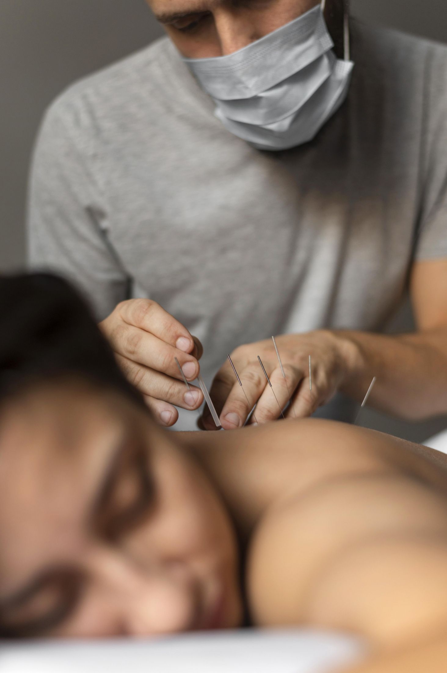 close-up-therapist-doing-acupuncture.jpg